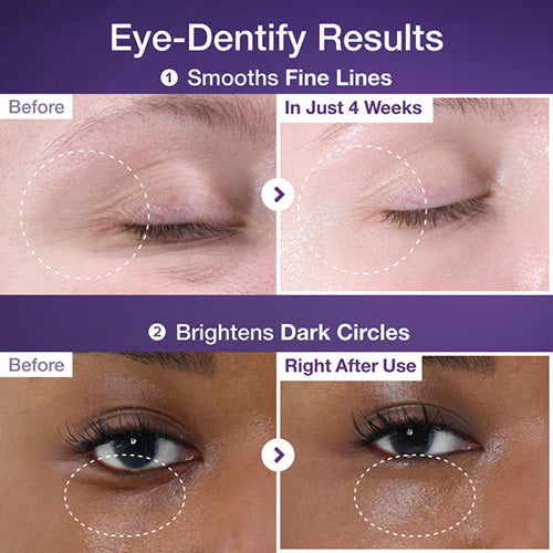 Numbuzin No.9 NAD Retinol Volumetox Eye Cream 10ml – Korean eye cream with retinol and NAD+, reduces fine lines and wrinkles, firms and hydrates delicate under-eye skin, brightens and revitalizes, suitable for all skin types.