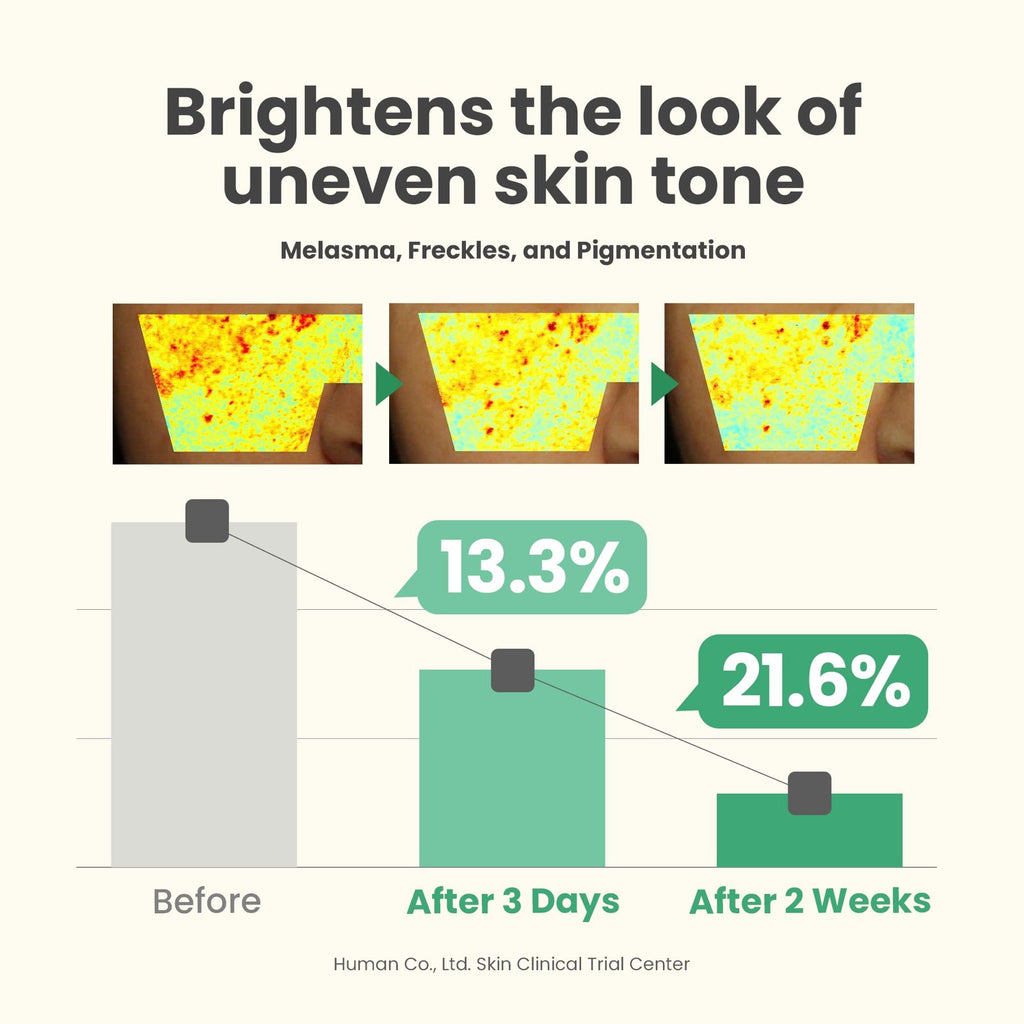 AXIS-Y Dark Spot Correcting Glow Serum 50ml – Korean brightening serum with niacinamide, reduces dark spots and hyperpigmentation, evens skin tone, boosts skin glow, lightweight and suitable for all skin types.