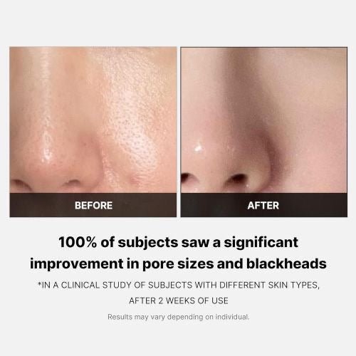 MEDICUBE Zero Pore Pad 2.0 – 70 Pads - Baresoul