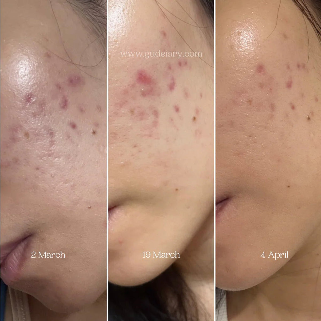 Numbuzin No.5 Glutathione Vitamin Concentrated Serum - Baresoul